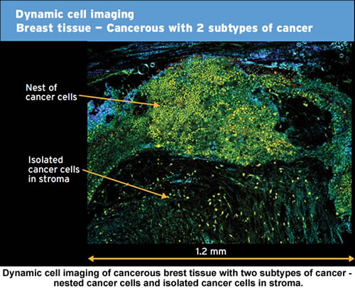 cancerous cell imaging vibration isolation