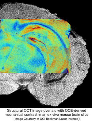 Structural OCT image overlaid with OCE-derived mechanical contrast in an ex vivo mouse brain slice